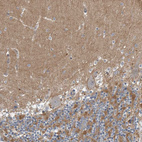 Immunohistochemical staining of human cerebellum shows moderate positivity in neuropil.
