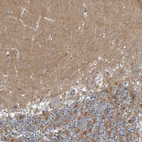 Immunohistochemical staining of human cerebellum shows moderate positivity in neuropil.