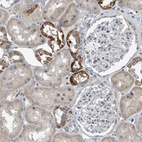 Immunohistochemical staining of human kidney shows strong cytoplasmic positivity in cells in distal tubules.