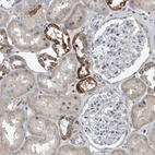 Immunohistochemical staining of human kidney shows strong cytoplasmic positivity in cells in distal tubules.