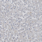 Immunohistochemical staining of human liver shows no in hepatocytes as expected.