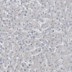 Immunohistochemical staining of human liver shows no in hepatocytes as expected.