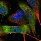 Immunofluorescent staining of human cell line U-251 MG shows localization to cytosol.