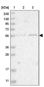 Anti-ZNF695 Antibody