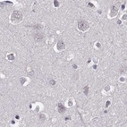 Immunohistochemical staining of human cerebral cortex using Anti-RP1L1 antibody HPA024744.