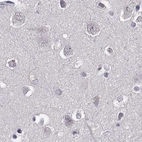Immunohistochemical staining of human cerebral cortex using Anti-RP1L1 antibody HPA024744.