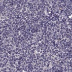 Immunohistochemical staining of human lymph node using Anti-RP1L1 antibody HPA024744.