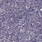 Immunohistochemical staining of human lymph node using Anti-RP1L1 antibody HPA024744.