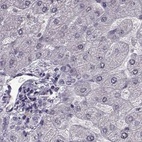 Immunohistochemical staining of human liver using Anti-RP1L1 antibody HPA024744.
