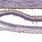 Immunohistochemical staining of human eye, retina using Anti-RP1L1 antibody HPA024744.