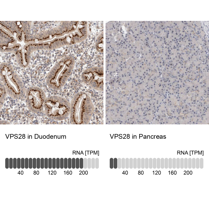 Anti-VPS28 Antibody