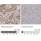 Anti-VPS28 Antibody