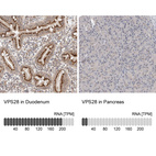 Anti-VPS28 Antibody