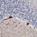 Anti-CA8 Antibody