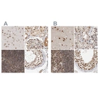 Anti-ZNF830 Antibody