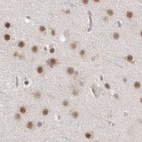 Anti-ZNF830 Antibody
