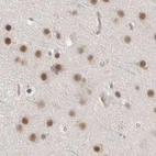 Immunohistochemical staining of human cerebral cortex using Anti-ZNF830 antibody HPA024754.