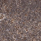 Immunohistochemical staining of human lymph node using Anti-ZNF830 antibody HPA024754.