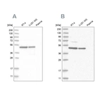 Western blot analysis using Anti-ZNF830 antibody HPA024754 (A) shows similar pattern to independent antibody HPA027211 (B).