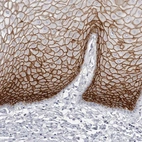Immunohistochemical staining of human cervix shows strong membranous positivity in squamous epithelial cells.