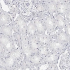 Immunohistochemical staining of human kidney shows no positivity in cells in tubules as expected.
