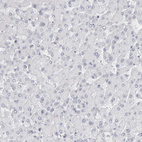 Anti-LY6D Antibody