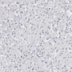 Immunohistochemical staining of human liver shows no positivity in hepatocytes as expected.