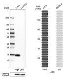 Western blot analysis in human cell lines A-431 and Caco-2 using Anti-LY6D antibody. Corresponding LY6D RNA-seq data are presented for the same cell lines. Loading control: Anti-PARP1.