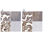 Immunohistochemical staining of human fallopian tube, lymph node, placenta and skeletal muscle using Anti-LRRC45 antibody HPA024768 (A) shows similar protein distribution across tissues to independent antibody HPA023372 (B).