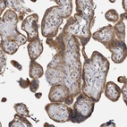 Immunohistochemical staining of human placenta shows moderate cytoplasmic positivity in trophoblastic cells.
