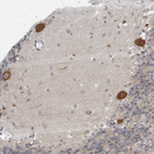 Immunohistochemical staining of human cerebellum shows moderate cytoplasmic positivity in purkinje cells.