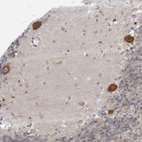 Immunohistochemical staining of human cerebellum shows moderate cytoplasmic positivity in purkinje cells.