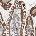 Immunohistochemical staining of human small intestine shows moderate cytoplasmic positivity in glandular cells.