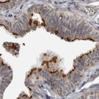Immunohistochemical staining of human fallopian tube using Anti-LRRC45 antibody HPA024768.