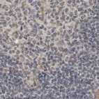 Immunohistochemical staining of human lymph node using Anti-LRRC45 antibody HPA024768.