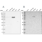 Western blot analysis using Anti-LRRC45 antibody HPA024768 (A) shows similar pattern to independent antibody HPA023382 (B).