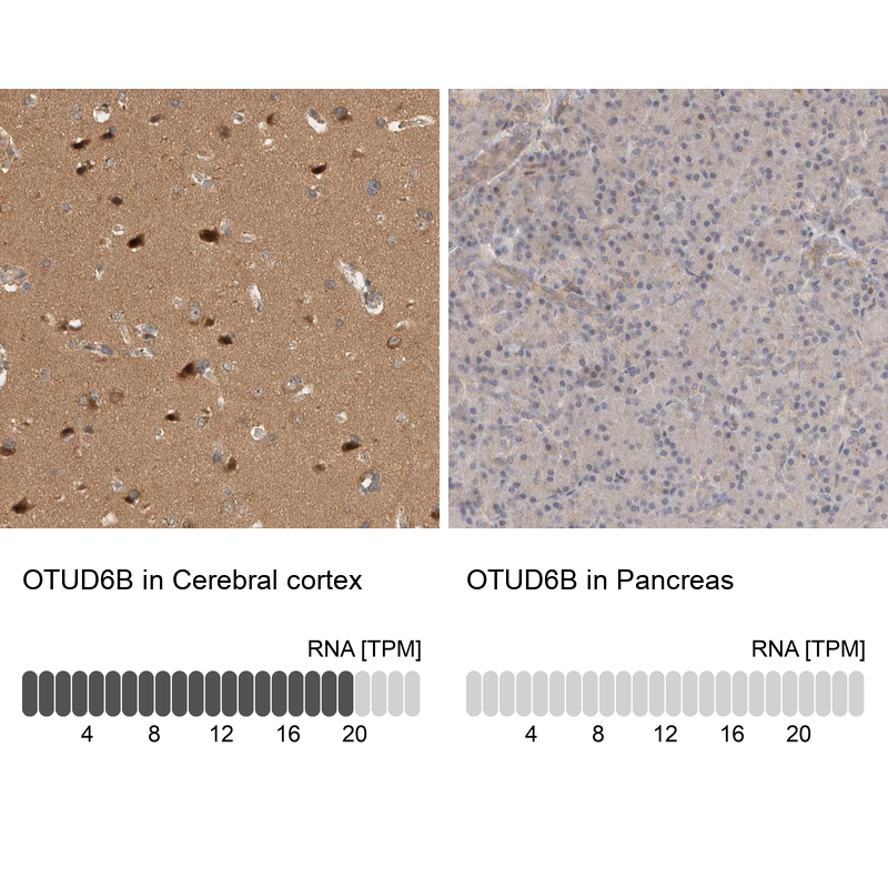 Anti-OTUD6B Antibody