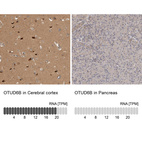 Anti-OTUD6B Antibody