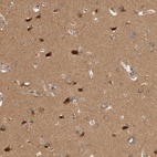 Immunohistochemical staining of human cerebral cortex shows high expression.