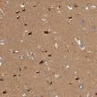 Immunohistochemical staining of human cerebral cortex shows high expression.