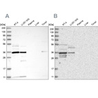 Western blot analysis using Anti-OTUD6B antibody HPA024772 (A) shows similar pattern to independent antibody HPA024046 (B).