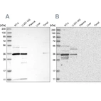 Western blot analysis using Anti-OTUD6B antibody HPA024772 (A) shows similar pattern to independent antibody HPA024046 (B).