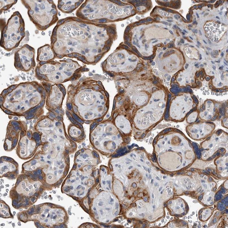 Anti-DPY19L4 Antibody