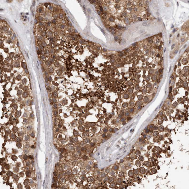 Anti-VPS37A Antibody