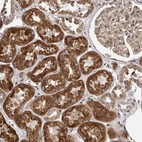 Immunohistochemical staining of human kidney shows strong cytoplasmic positivity in cells in tubules.