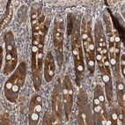 Immunohistochemical staining of human duodenum shows strong cytoplasmic positivity in glandular cells.