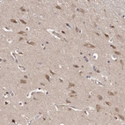 Immunohistochemical staining of human cerebral cortex shows moderate cytoplasmic positivity in neurons.