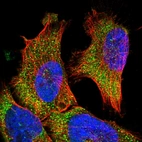 Immunofluorescent staining of human cell line U-251 MG shows localization to vesicles.