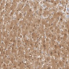 Immunohistochemical staining of human liver shows high expression.