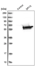 Western blot analysis in control (vector only transfected HEK293T lysate) and DPYS over-expression lysate (Co-expressed with a C-terminal myc-DDK tag (~3.1 kDa) in mammalian HEK293T cells, LY419991).
